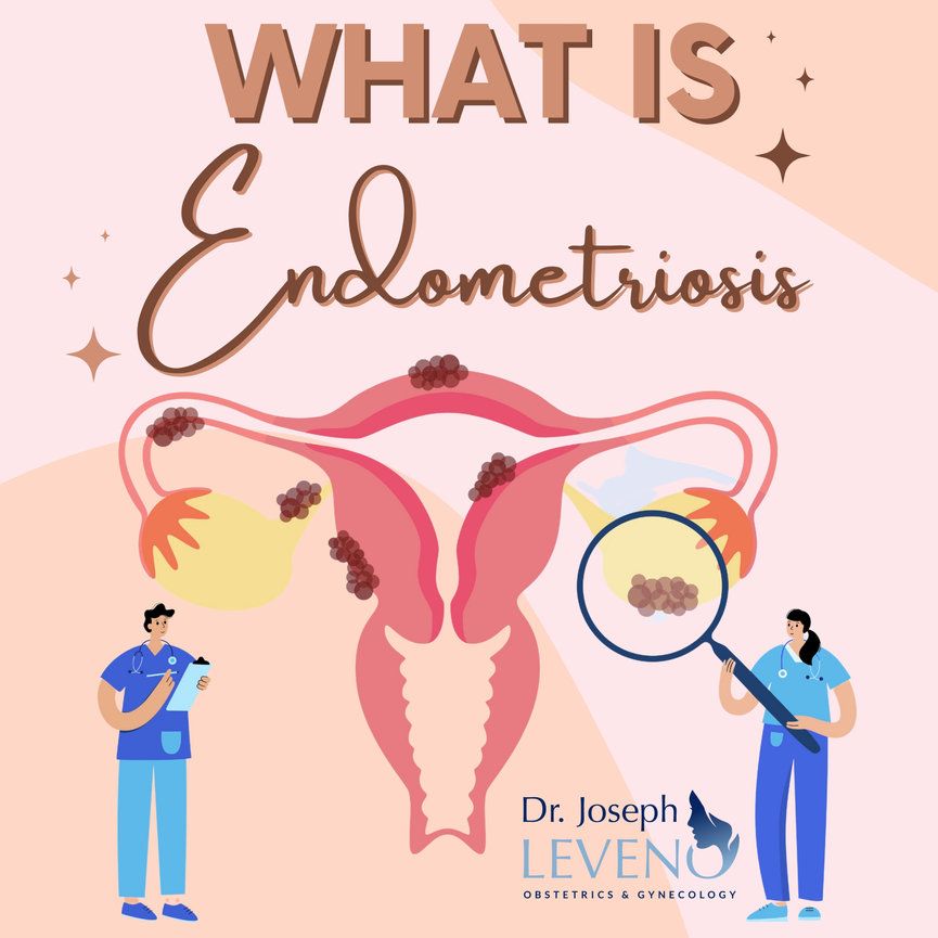 WhatIsEndometriosisWomen'sHealth Dr. Joseph Leveno