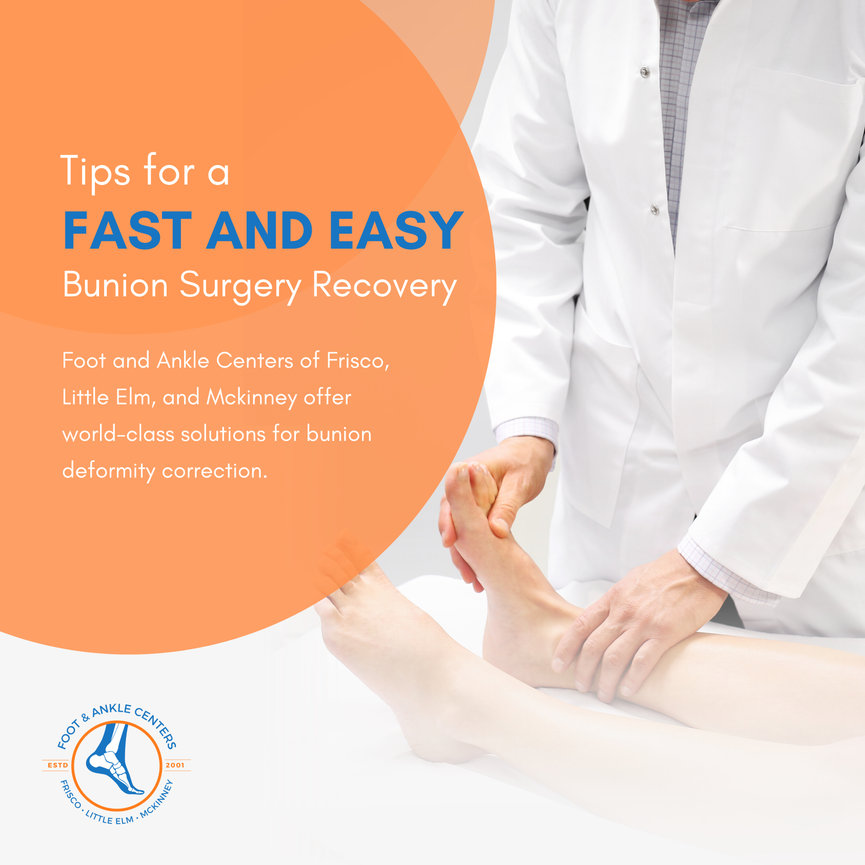Tips for a Fast and Easy Bunion Surgery Recovery Foot & Ankle Centers