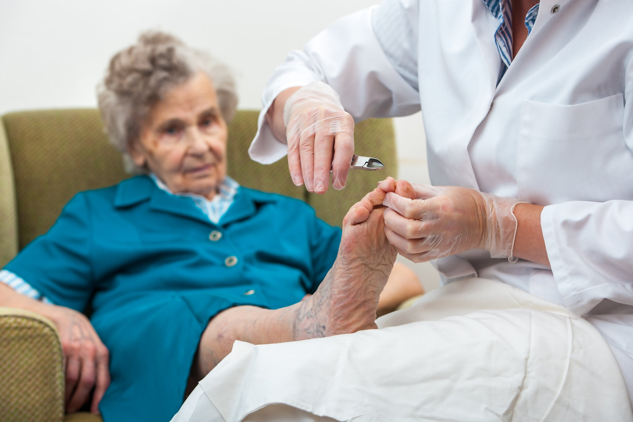 Treating Foot Wart
